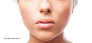 دلایل پیری پوست چیست؟ + معرفی محصولات فوراور برای آبرسانی به پوست