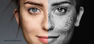 تاثیر آلودگی هوا بر پوست و مو ( راه های جلوگیری از این مشکل )