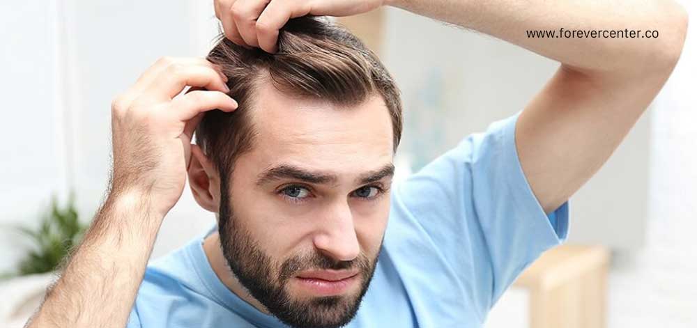 علت ریز مو در مردان